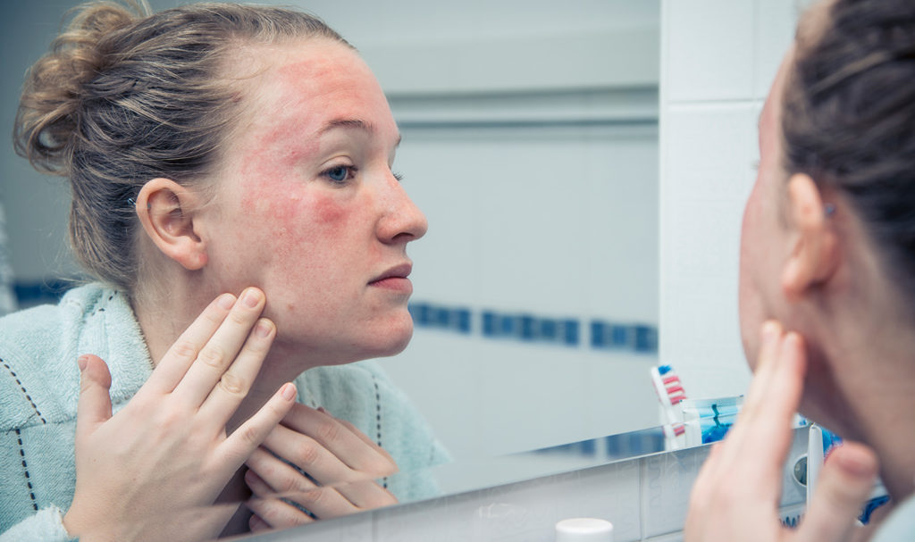 A woman has a rash on her skin after using a product she purchased a while back. Discontinued Products Coverage on a product liability coverage may cover a claim like this.